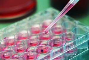 Sona Engages Clinical Trial Clinic for First-in-Human Early Feasibility Study of its THT Cancer Therapy