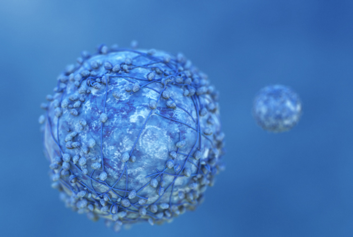 _First Patient Dosed in Early Feasibility Study Trial of Its Cancer Therapy